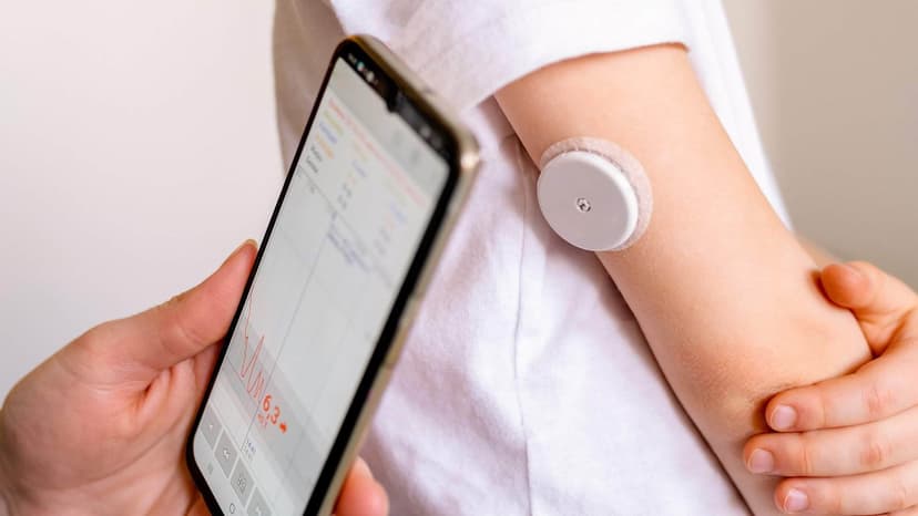 Непрерывный мониторинг глюкозы