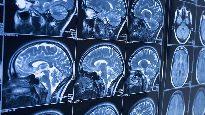 Интерпретация КТ-исследований